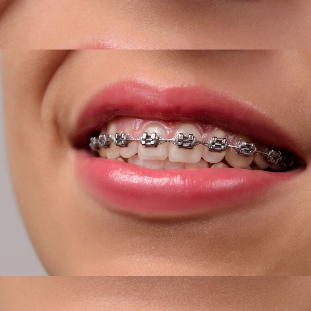 Orthodontic services Sikar